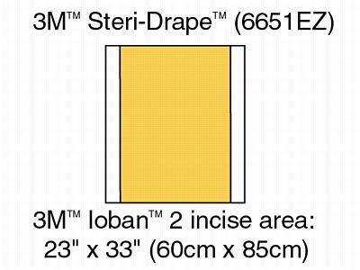 ioban dressing 3M 6651EZ Ioban 2 Antimicrobial Incise Drape